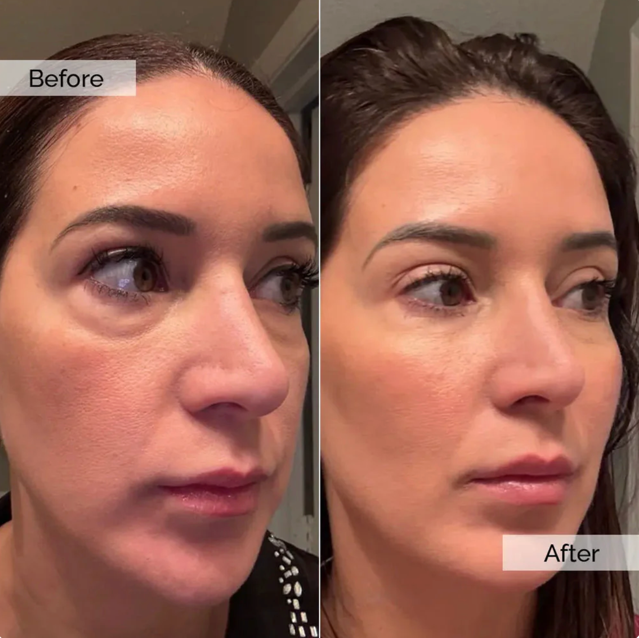 SilkLift Collagen Peptide Ampoule