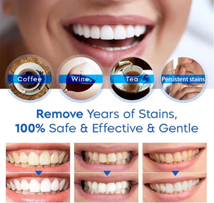 Nuvenci - Teeth Whitening Pen